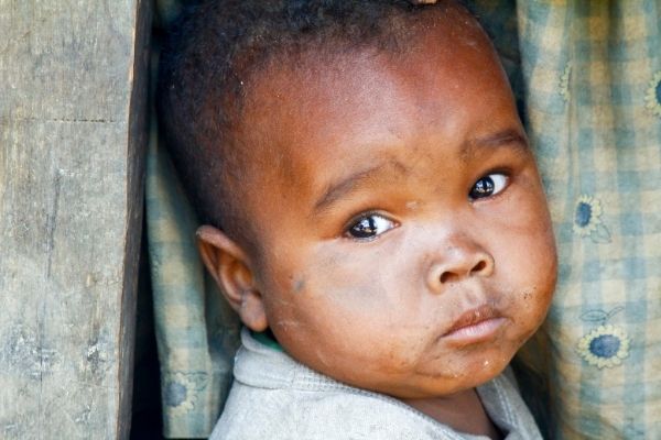 TDR: Joint Call for Strengthening Health Systems in East Africa