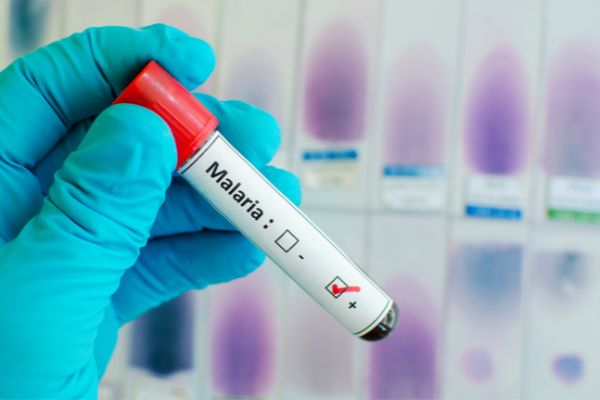 NOFO: Monitoring, Operations Research, Evaluation of Tools for Malaria Control and Prevention in Kenya