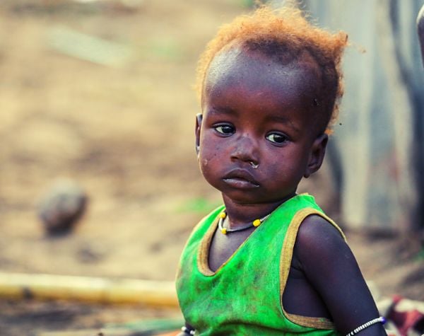 Call for Concepts to implement the USAID Primary Health Care Improvement Program